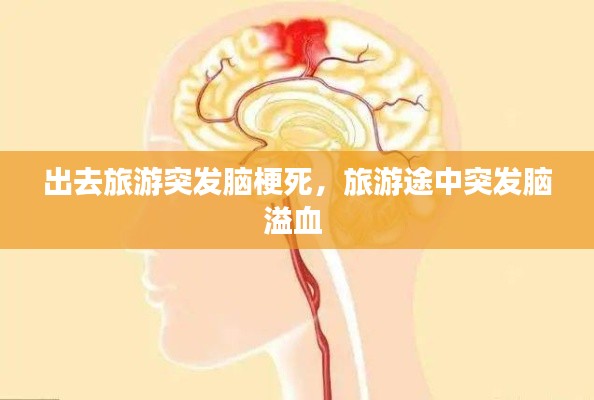 出去旅游突发脑梗死,旅游途中突发脑溢血