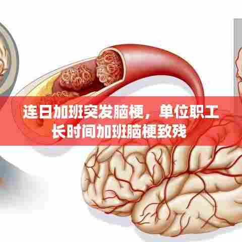 连日加班突发脑梗,单位职工长时间加班脑梗致残