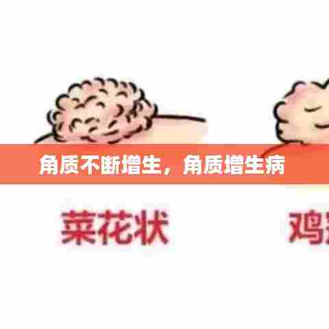 角质不断增生,角质增生病