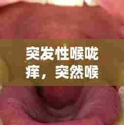 突发性喉咙痒,突然喉咙痒怎么缓解