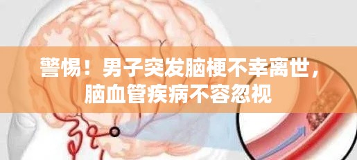 警惕!男子突发脑梗不幸离世,脑血管疾病不容忽视