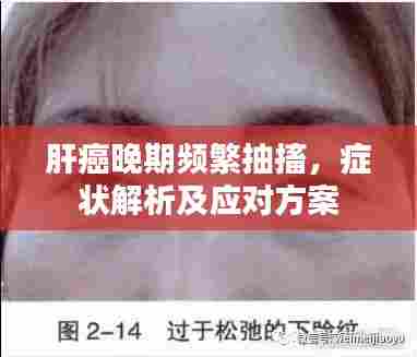 肝癌晚期频繁抽搐,症状解析及应对方案